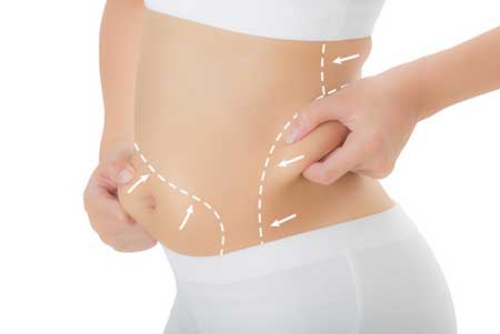 تفاوت لیپوساکشن به روش دستی و لیپوماتیک